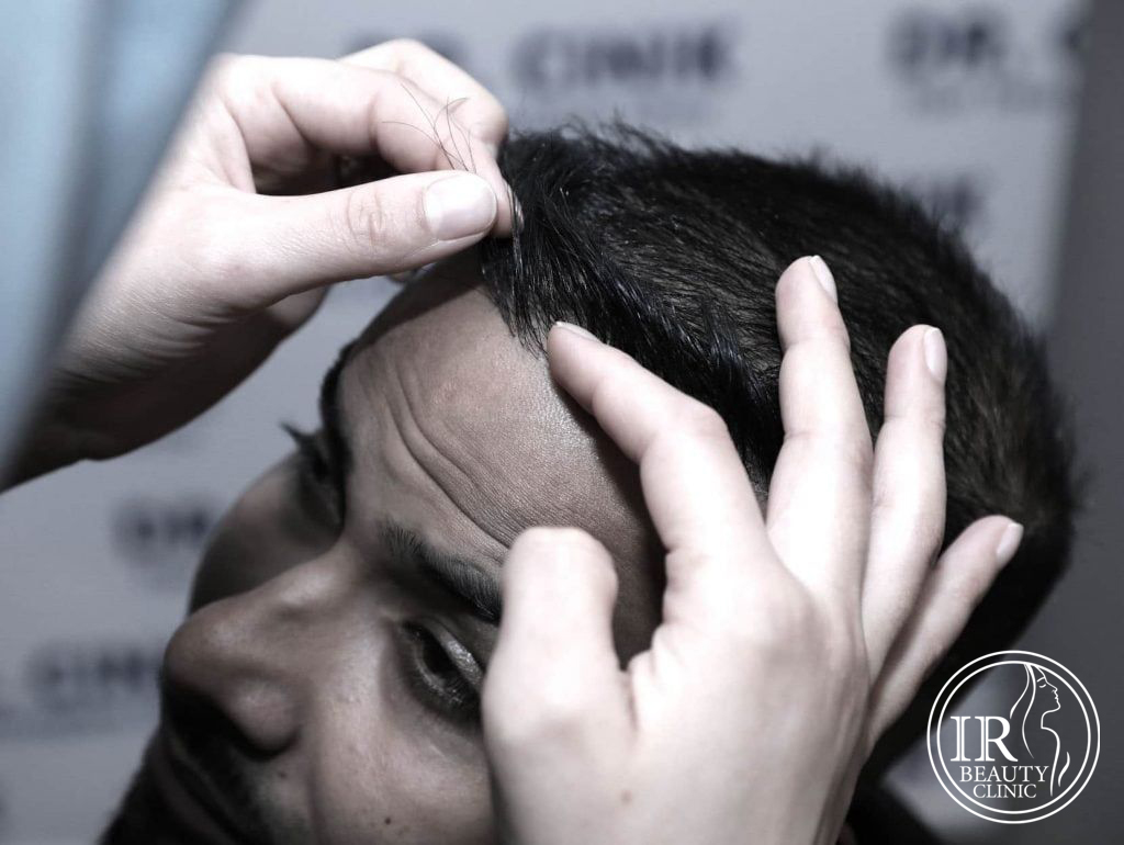 کاشت مو تهران