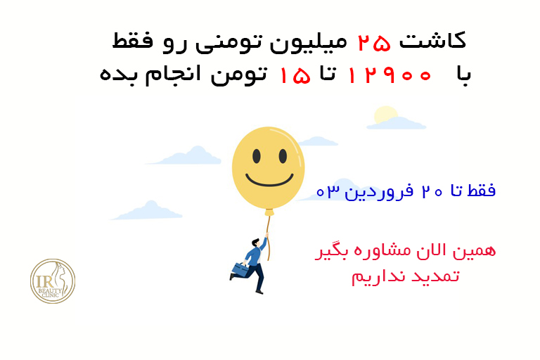 کاشت مو ارزان