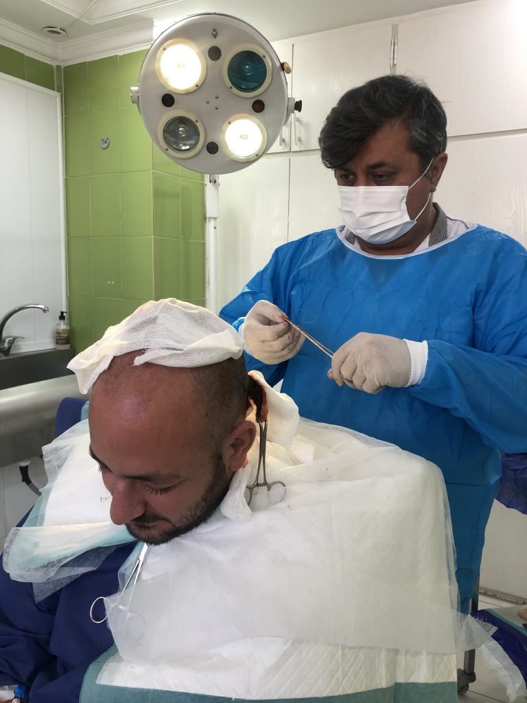 کاشت مو تهران